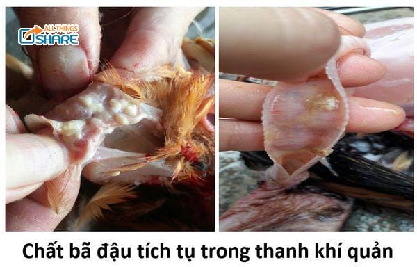 Triệu chứng của bệnh ORT